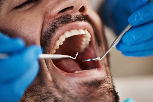 Best Knocked-Out Tooth Emergency  in Velva, ND