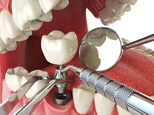 Best Urgent Tooth Repair  in Velva, ND